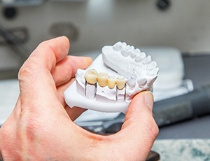 Lab artisan holding model of dental bridge