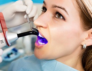 Dentist curing a patient’s tooth-colored filling