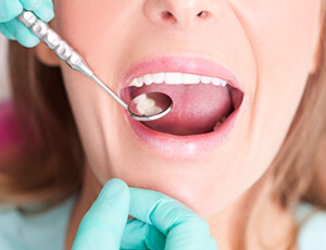 Filling repaired tooth enlarged with dental mirror