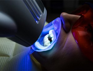 a patient undergoing in-office teeth whitening treatment