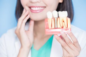 Woman holding dental implant model