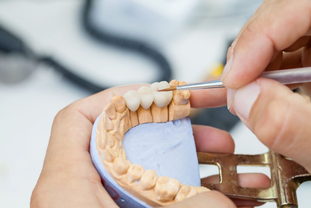 Tech detailing dental bridge on cast of lower teeth