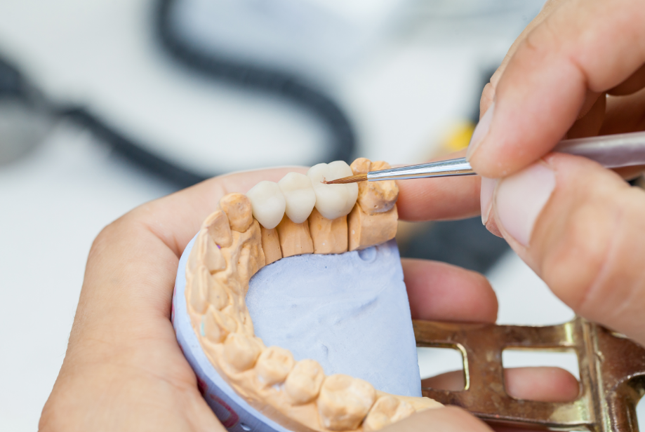 Dental crown mold
